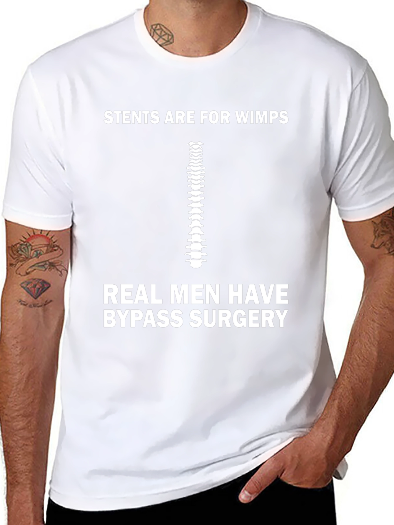 Stents Are For Wimps Bypass Surgery T-Shirt