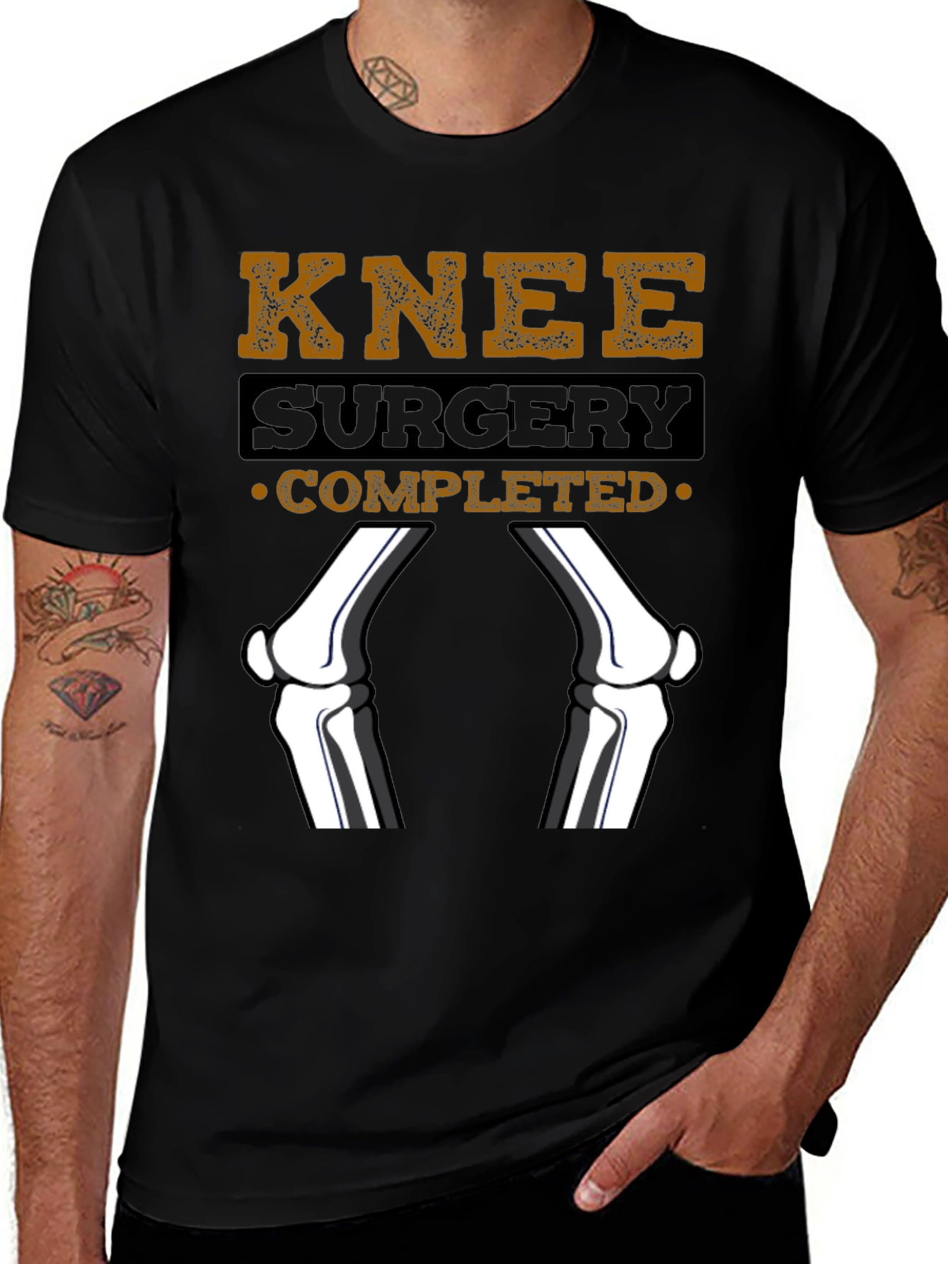 Knee Surgery Completed Graphic T-Shirt